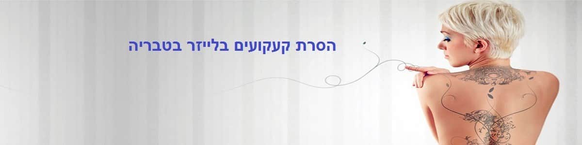 הסרת קעקועים בלייזר בטבריה | הסרת קעקוע בלייזר בטבריה